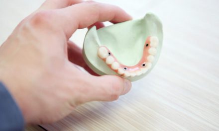 Losse tanden: wordt het beter?