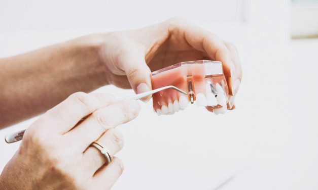Manieren om de pijn te verlichten na het plaatsen van implantaten